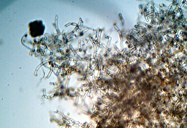 Botryobasidium isabellinum... un 